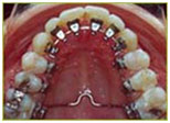 Orthodontics10
