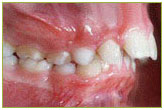 Orthodontics2