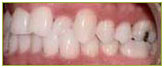 Orthodontics4