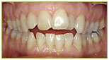 Orthodontics5