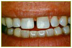 Orthodontics6
