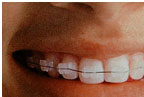 Orthodontics8